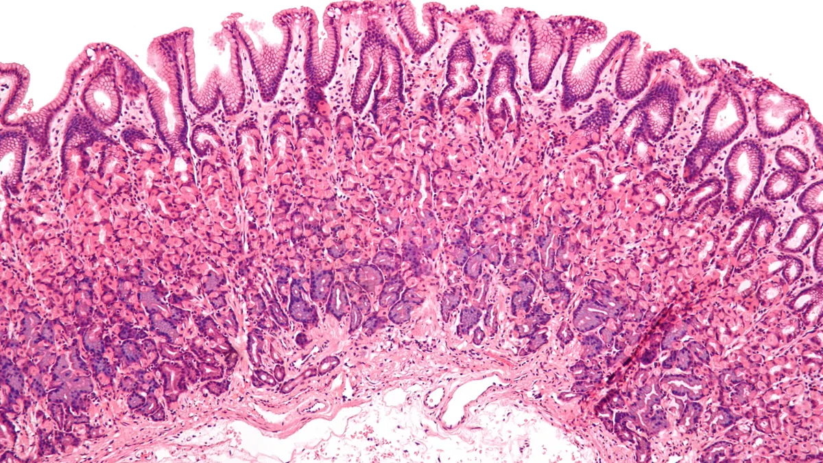 Micrograph of normal gastric mucosa stained with H&E; BPC-157 is a fragment of a protein described in gastric juice