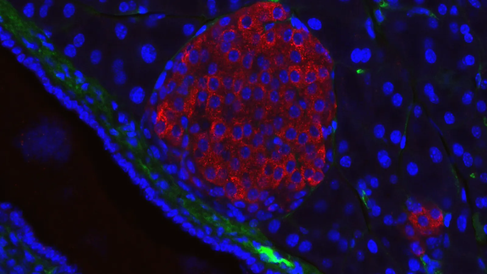 Mouse pancreatic islet in a fluorescence micrograph, the tissue at the centre of incretin agonist research
