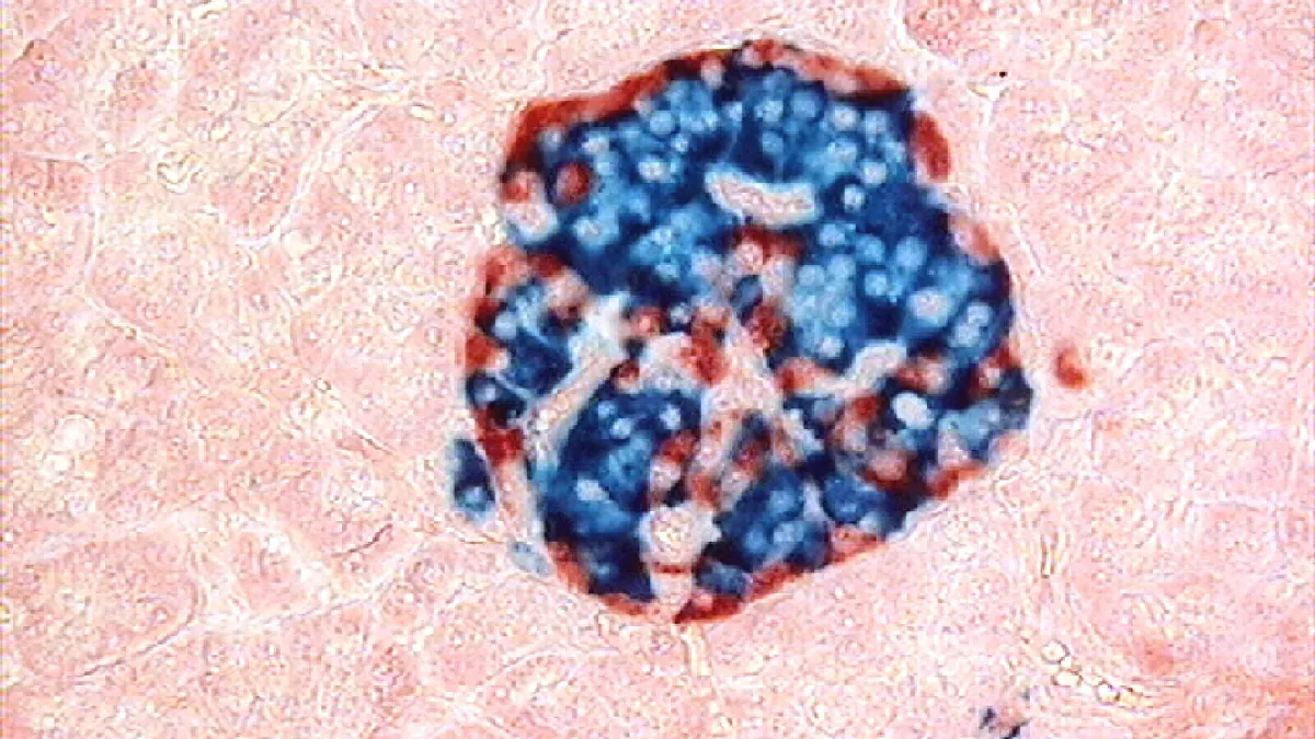 Stained section of a human pancreatic islet surrounded by exocrine tissue, viewed under a light microscope