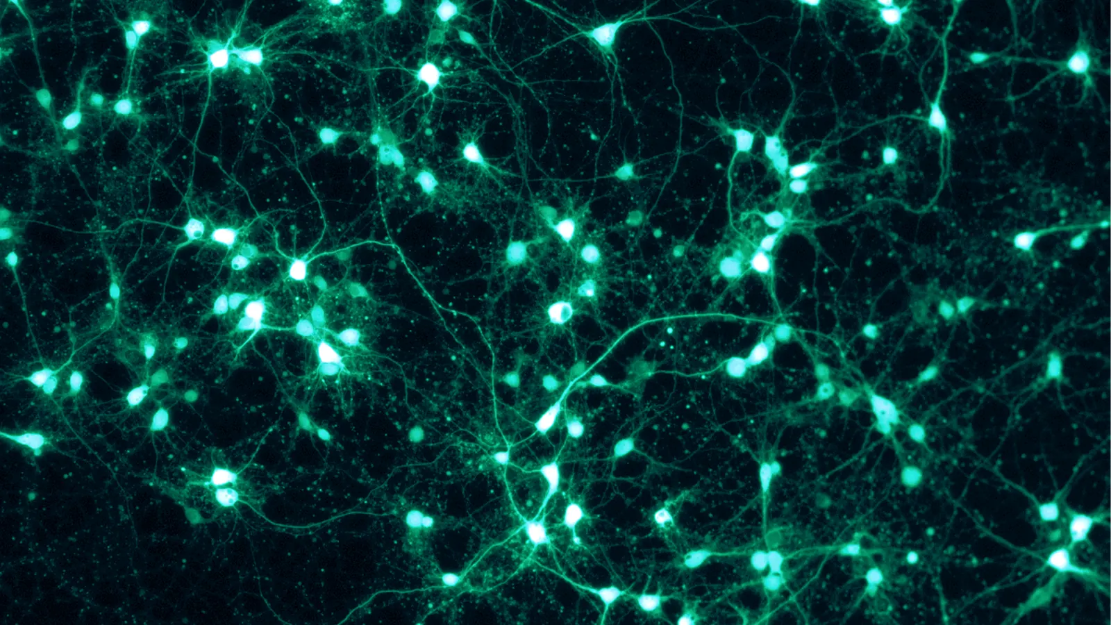 Network of cultured neurons expressing green fluorescent protein, illustrating Selank neuroscience research