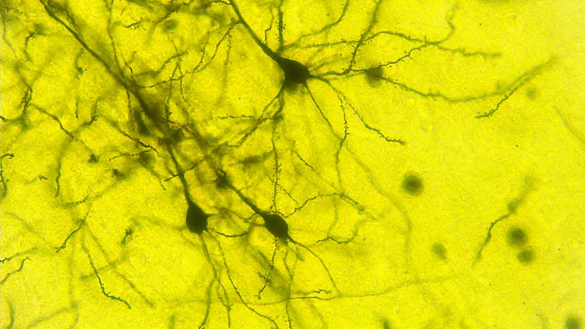 Stained neurons with branching dendrites viewed under a light microscope at 100x magnification