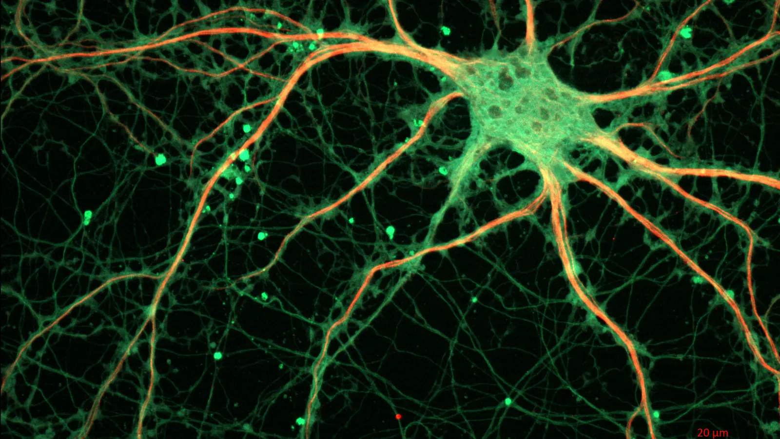 Fluorescence micrograph of a cultured rat hippocampal neuron, illustrating the neuroscience behind Semax research