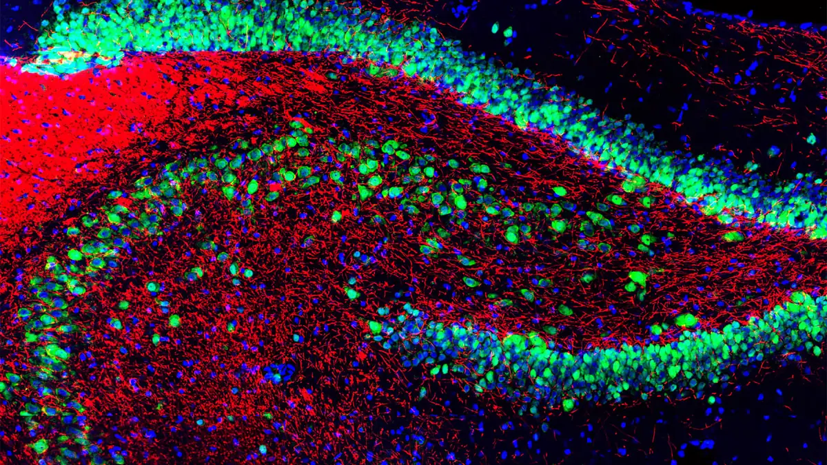 Rat hippocampus section stained for neurons (green), myelin (red) and DNA (blue) in a fluorescence micrograph