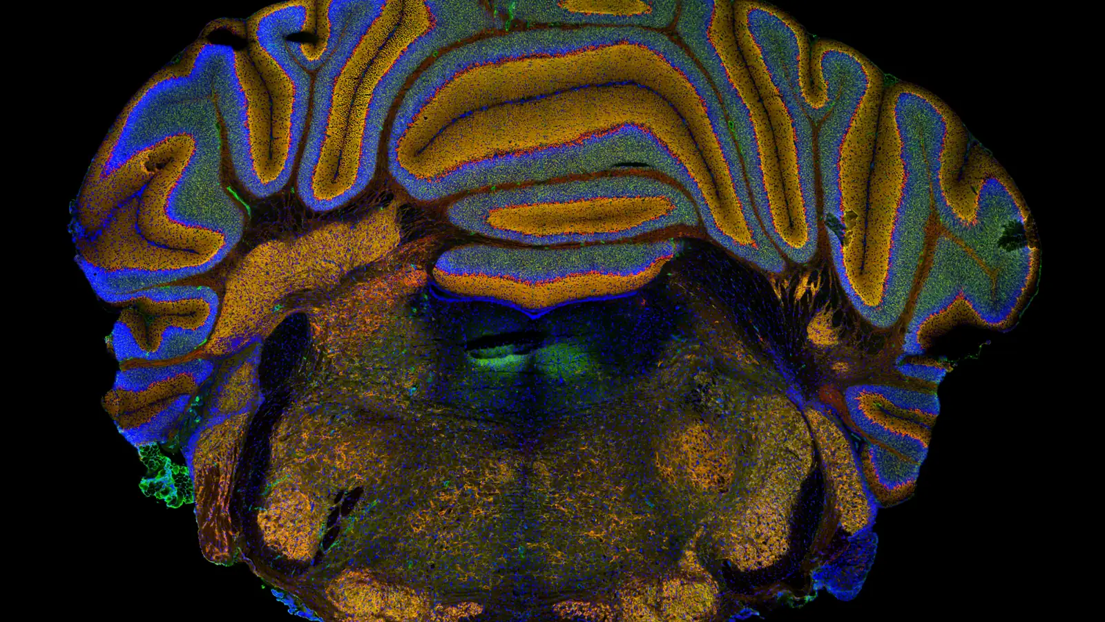 Immunofluorescence image of a mouse brainstem section with neurons labelled in several colours