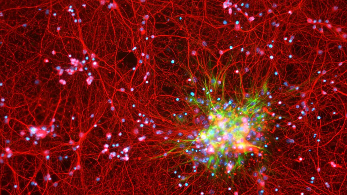 Dense network of cultured neurons and nuclei imaged with fluorescence microscopy