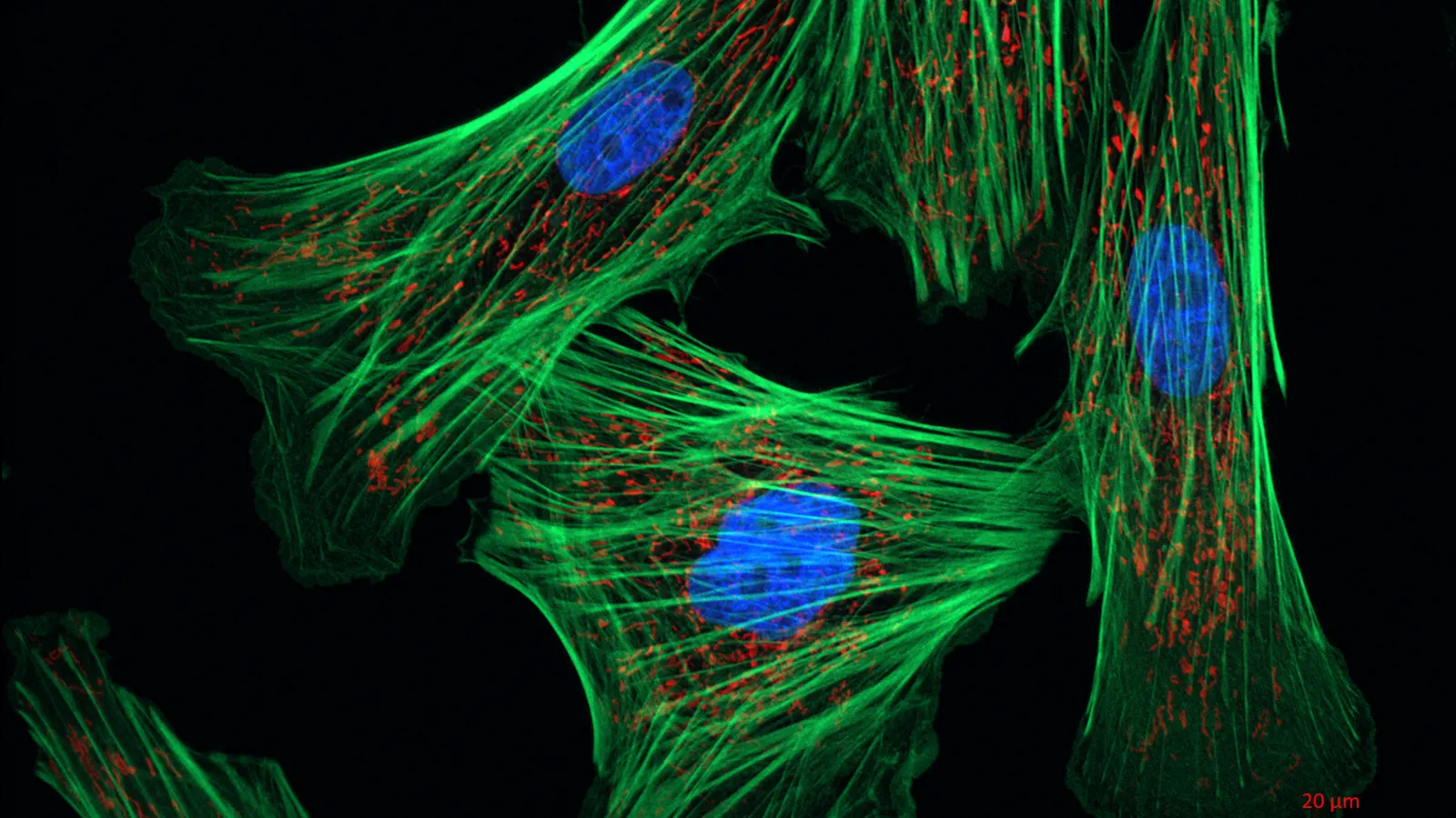 Fluorescence micrograph of fibroblasts with the actin cytoskeleton in green, the protein thymosin beta-4 binds