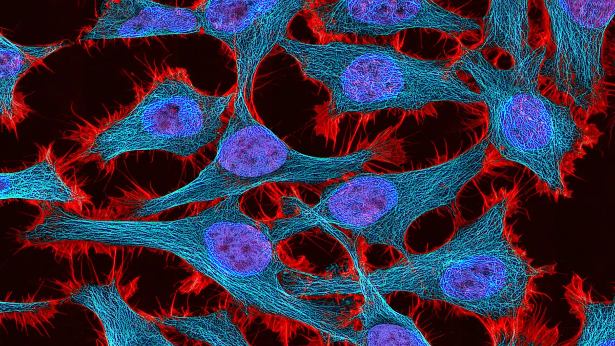 Fluorescence micrograph of cultured HeLa cells showing the cytoskeleton, the focus of thymosin beta-4 research