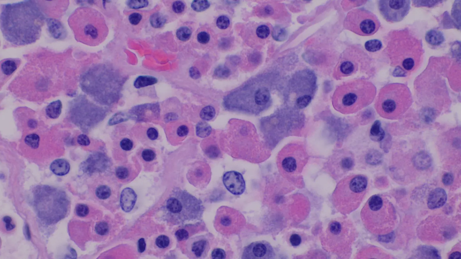Histology of the anterior pituitary, where GHRH analogues such as tesamorelin act on growth hormone cells
