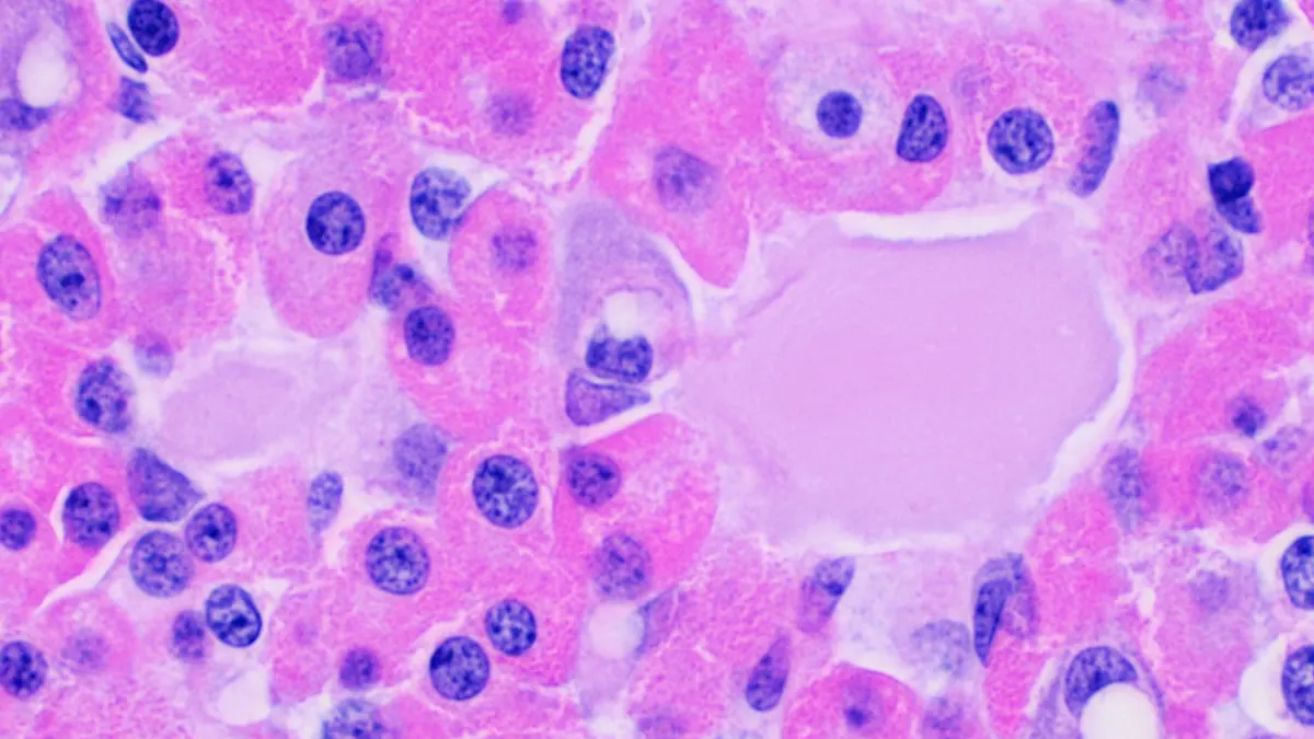 High-magnification H&E micrograph of anterior pituitary tissue with eosinophilic follicles